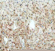 IHC staining of FFPE zebrafish heart tissue with Zebrafish Leo1 antibody, HRP-labeled secondary and DAB substrate. HIER: boil tissue sections in pH8 EDTA for 20 min and allow to cool before testing.