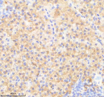 IHC staining of FFPE zebrafish liver tissue with Ppp1r12a antibody, HRP-labeled secondary and DAB substrate. HIER: boil tissue sections in pH8 EDTA for 20 min and allow to cool before testing.