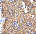 IHC staining of zebrafish Ndr1 protein using Zebrafish Ndr1 antibody, HRP-labeled secondary and DAB substrate. Ndr1 was detected in a paraffin-embedded section of zebrafish pancreas tissue. HIER: boil tissue sections in pH8 EDTA for 20 min and allow to cool before testing.