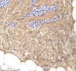 IHC staining of zebrafish Nploc4 protein using Zebrafish Nploc4 antibody, HRP-labeled secondary and DAB substrate. Nploc4 was detected in a paraffin-embedded section of zebrafish heart tissue. HIER: boil tissue sections in pH8 EDTA for 20 min and allow to cool before testing.