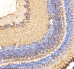 IHC staining of zebrafish Ornithine aminotransferase protein using Zebrafish Ornithine aminotransferase antibody, HRP-labeled secondary and DAB substrate. Ornithine aminotransferase was detected in a paraffin-embedded section of zebrafish eye tissue. HIER: boil tissue sections in pH8 EDTA for 20 min and allow to cool before testing.