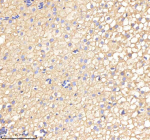 IHC staining of zebrafish Ornithine aminotransferase protein using Zebrafish Ornithine aminotransferase antibody, HRP-labeled secondary and DAB substrate. Ornithine aminotransferase was detected in a paraffin-embedded section of zebrafish liver tissue. HIER: boil tissue sections in pH8 EDTA for 20 min and allow to cool before testing.