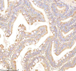 IHC staining of zebrafish Ornithine aminotransferase protein using Zebrafish Ornithine aminotransferase antibody, HRP-labeled secondary and DAB substrate. Ornithine aminotransferase was detected in a paraffin-embedded section of zebrafish colon tissue. HIER: boil tissue sections in pH8 EDTA for 20 min and allow to cool before testing.