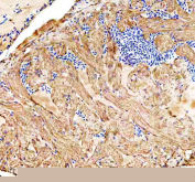 IHC staining of FFPE zebrafish heart tissue with Ostf1 antibody, HRP-labeled secondary and DAB substrate. HIER: boil tissue sections in pH8 EDTA for 20 min and allow to cool before testing.
