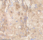 IHC staining of zebrafish Pdcd10a/b protein using Zebrafish Pdcd10 antibody, HRP-labeled secondary and DAB substrate. Pdcd10 was detected in a paraffin-embedded section of zebrafish brain tissue. HIER: boil tissue sections in pH8 EDTA for 20 min and allow to cool before testing.