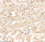 IHC staining of FFPE zebrafish heart tissue with Psma1 antibody, HRP-labeled secondary and DAB substrate. HIER: boil tissue sections in pH8 EDTA for 20 min and allow to cool before testing.