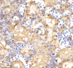 IHC staining of FFPE zebrafish kidney tissue with Psma1 antibody, HRP-labeled secondary and DAB substrate. HIER: boil tissue sections in pH8 EDTA for 20 min and allow to cool before testing.