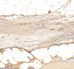 IHC staining of FFPE zebrafish spinal tissue with Psmd6 antibody, HRP-labeled secondary and DAB substrate. HIER: boil tissue sections in pH8 EDTA for 20 min and allow to cool before testing.