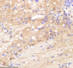 IHC staining of FFPE zebrafish brain tissue with Rcc2 antibody, HRP-labeled secondary and DAB substrate. HIER: boil tissue sections in pH8 EDTA for 20 min and allow to cool before testing.
