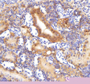 IHC staining of zebrafish Sf3b3 protein using Zebrafish Sf3b3 antibody, HRP-labeled secondary and DAB substrate. Sf3b3 was detected in a paraffin-embedded section of zebrafish kidney tissue. HIER: boil tissue sections in pH8 EDTA for 20 min and allow to cool before testing.