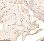 IHC staining of FFPE zebrafish muscle tissue with Twist antibody, HRP-labeled secondary and DAB substrate. HIER: boil tissue sections in pH8 EDTA for 20 min and allow to cool before testing.