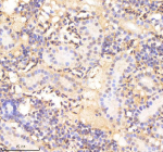 IHC staining of FFPE zebrafish kidney tissue with Twist antibody, HRP-labeled secondary and DAB substrate. HIER: boil tissue sections in pH8 EDTA for 20 min and allow to cool before testing.