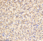 IHC staining of FFPE zebrafish liver tissue with Cdc48 antibody, HRP-labeled secondary and DAB substrate. HIER: boil tissue sections in pH8 EDTA for 20 min and allow to cool before testing.