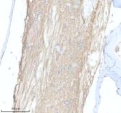 Zebrafish CXCR7A Antibody Spinal Cord IHC. Immunohistochemistry staining of FFPE zebrafish spinal cord tissue using Zebrafish CXCR7A Antibody demonstrates diffuse cytoplasmic and membrane-associated HRP-DAB brown staining throughout elongated neural tissue structures. The staining pattern is consistent with expression of CXC Chemokine Receptor 7A (CXCR7A), also known as Atypical Chemokine Receptor 3A (ACKR3A), a chemokine receptor involved in regulation of CXCL12 signaling, cell migration, and developmental tissue patterning. Signal is observed within spinal cord-associated cellular compartments and neural processes, reflecting the established role of CXCR7A in directing cellular positioning and organization during vertebrate development. Heat mediated antigen retrieval was performed in EDTA buffer. Primary antibody was incubated overnight at 4Â°C followed by detection using a peroxidase-conjugated goat anti-rabbit secondary antibody and DAB chromogen.