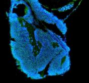 Zebrafish IGF1 Receptor / IGF1RA Antibody Embryo IF. Immunofluorescent staining of FFPE zebrafish embryo tissue using Zebrafish IGF1 Receptor Antibody demonstrates distinct green fluorescence within developing embryonic tissue compartments against a blue DAPI nuclear counterstain background. The staining pattern is consistent with expression of Insulin-Like Growth Factor 1 Receptor Alpha (IGF1RA), a receptor tyrosine kinase that mediates growth factor signaling involved in cellular proliferation, differentiation, survival, and developmental regulation. Signal is observed throughout embryonic structures undergoing active growth and morphogenesis, reflecting the established role of IGF signaling pathways in vertebrate development. Heat mediated antigen retrieval was performed in EDTA buffer. Primary antibody was incubated overnight at 4Â°C followed by detection using a DyLight 488-conjugated goat anti-rabbit secondary antibody. Nuclei were counterstained with DAPI.