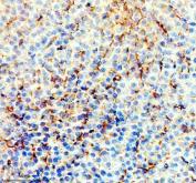 Zebrafish ACACA / Acetyl-CoA Carboxylase 1 Antibody Liver IHC. Immunohistochemistry staining of FFPE zebrafish liver tissue using Zebrafish ACACA Antibody demonstrates granular cytoplasmic HRP-DAB brown staining throughout hepatocyte-associated cellular populations. The staining pattern is consistent with expression of Acetyl-CoA Carboxylase 1 (ACACA), also known as ACC1, a rate-limiting enzyme in de novo fatty acid biosynthesis that catalyzes the conversion of acetyl-CoA to malonyl-CoA. Prominent hepatic staining is consistent with the central role of ACACA in lipid metabolism, energy storage, and regulation of fatty acid synthesis within the liver. Heat mediated antigen retrieval was performed in EDTA buffer. Primary antibody was incubated overnight at 4Â°C followed by detection using a peroxidase-conjugated goat anti-rabbit secondary antibody and DAB chromogen.
