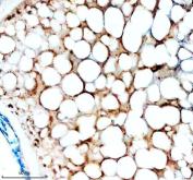 Zebrafish ACACA / Acetyl-CoA Carboxylase 1 Antibody Ovary IHC. Immunohistochemistry staining of FFPE zebrafish ovary tissue using Zebrafish ACACA Antibody demonstrates cytoplasmic HRP-DAB brown staining within ovarian follicular and oocyte-associated cellular compartments. The staining pattern is consistent with expression of Acetyl-CoA Carboxylase 1 (ACACA), also known as ACC1, a rate-limiting enzyme in fatty acid biosynthesis that catalyzes the formation of malonyl-CoA from acetyl-CoA. Prominent staining within lipid-rich ovarian tissue is consistent with the essential role of ACACA in lipid metabolism, membrane biogenesis, energy storage, and reproductive tissue development. Heat mediated antigen retrieval was performed in EDTA buffer. Primary antibody was incubated overnight at 4Â°C followed by detection using a peroxidase-conjugated goat anti-rabbit secondary antibody and DAB chromogen.