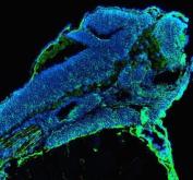 Zebrafish ACACA / Acetyl-CoA Carboxylase 1 Antibody Embryo IF. Immunofluorescent staining of FFPE zebrafish embryo tissue using Zebrafish ACACA Antibody demonstrates distinct green fluorescence throughout developing embryonic tissue compartments against a blue DAPI nuclear counterstain background. The staining pattern is consistent with expression of Acetyl-CoA Carboxylase 1 (ACACA), also known as ACC1, a rate-limiting enzyme in de novo fatty acid biosynthesis that catalyzes the conversion of acetyl-CoA to malonyl-CoA. Signal is observed within embryonic structures undergoing active growth and metabolic development, reflecting the essential role of ACACA in lipid synthesis, membrane biogenesis, and cellular energy homeostasis during vertebrate embryogenesis. Heat mediated antigen retrieval was performed in EDTA buffer. Primary antibody was incubated overnight at 4oC followed by detection using a DyLight 488-conjugated goat anti-rabbit secondary antibody. Nuclei were counterstained with DAPI.