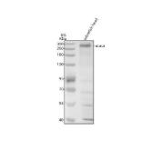 Zebrafish ACACA / Acetyl-CoA Carboxylase 1 Antibody Lipid Metabolism WB. Western blot analysis of zebrafish head tissue lysate using Zebrafish ACACA Antibody demonstrates a prominent immunoreactive band at approximately 269 kDa, consistent with the predicted molecular weight of Acetyl-CoA Carboxylase 1 (ACACA), also known as ACC1. ACACA is a biotin-dependent enzyme that catalyzes the conversion of acetyl-CoA to malonyl-CoA, the committed and rate-limiting step in de novo fatty acid biosynthesis. The observed band is consistent with expression of this key metabolic regulator, which plays an essential role in lipid synthesis, energy storage, membrane biogenesis, and cellular metabolic homeostasis. Electrophoresis was performed on an 8% SDS-PAGE gel under reducing conditions followed by transfer to a nitrocellulose membrane. Signal was detected using an HRP-conjugated secondary antibody and enhanced chemiluminescent substrate. Predicted molecular weight: ~269 kDa. Observed molecular weight: ~269 kDa.