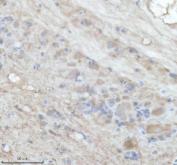 Zebrafish IL-4 Antibody IHC. Immunohistochemistry analysis of IL4 using anti-IL4 antibody. IL4 was detected in a paraffin-embedded section of zebrafish brain tissue. Heat mediated antigen retrieval was performed in EDTA buffer. The tissue section was blocked with 10% goat serum. The tissue section was then incubated with 2 ug/ml rabbit anti-IL4 Antibody overnight at 4oC. Peroxidase Conjugated Goat Anti-rabbit IgG was used as secondary antibody and incubated for 30 minutes at 37oC. The tissue section was developed using DAB as the chromogen.