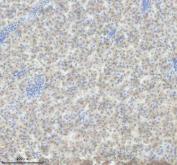 Zebrafish IL-4 Antibody IHC. Immunohistochemistry analysis of IL4 using anti-IL4 antibody. IL4 was detected in a paraffin-embedded section of zebrafish liver tissue. Heat mediated antigen retrieval was performed in EDTA buffer. The tissue section was blocked with 10% goat serum. The tissue section was then incubated with 2 ug/ml rabbit anti-IL4 Antibody overnight at 4oC. Peroxidase Conjugated Goat Anti-rabbit IgG was used as secondary antibody and incubated for 30 minutes at 37oC. The tissue section was developed using DAB as the chromogen.