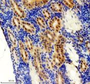 Zebrafish FOXJ1 / FOXJ1A Antibody Kidney IHC. Immunohistochemistry staining of FFPE zebrafish kidney tissue using Zebrafish FOXJ1 Antibody demonstrates prominent nuclear and cytoplasmic HRP-DAB brown staining within renal tubular epithelial cell populations. The staining pattern is consistent with expression of Forkhead Box J1A (FOXJ1A), a transcription factor that serves as a master regulator of motile ciliogenesis and ciliated cell differentiation. Strong epithelial-associated staining is consistent with the established role of FOXJ1A in regulating genes required for cilia formation, ciliary motility, and maintenance of specialized epithelial cell functions. Heat mediated antigen retrieval was performed in EDTA buffer. Primary antibody was incubated overnight at 4Â°C followed by detection using a peroxidase-conjugated goat anti-rabbit secondary antibody and DAB chromogen.