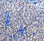Zebrafish ACVR1L / ALK8 Antibody Liver IHC. Immunohistochemistry staining of FFPE zebrafish liver tissue using Zebrafish ACVR1L Antibody demonstrates widespread cytoplasmic HRP-DAB brown staining throughout hepatocyte populations. The staining pattern is consistent with expression of Activin Receptor Type 1-Like (ACVR1L), also known as ALK8, a transmembrane serine/threonine kinase receptor that mediates BMP and TGF-beta signaling pathways. Hepatic expression of ACVR1L is consistent with the broad involvement of BMP receptor signaling in cellular differentiation, tissue homeostasis, developmental regulation, and growth factor-mediated signaling processes. Heat mediated antigen retrieval was performed in EDTA buffer. Primary antibody was incubated overnight at 4Â°C followed by detection using a peroxidase-conjugated goat anti-rabbit secondary antibody and DAB chromogen.