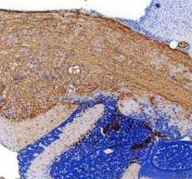 Zebrafish ACVR1L / ALK8 Antibody Brain IHC. Immunohistochemistry staining of FFPE zebrafish brain tissue using Zebrafish ACVR1L Antibody demonstrates widespread cytoplasmic HRP-DAB brown staining throughout neural tissue regions, with prominent immunoreactivity observed in densely cellular brain-associated structures. The staining pattern is consistent with expression of Activin Receptor Type 1-Like (ACVR1L), also known as ALK8, a serine/threonine kinase receptor that mediates BMP and TGF-beta signaling during vertebrate development. Expression within neural tissues is consistent with the established role of ACVR1L in embryonic patterning, neural development, cellular differentiation, and regulation of developmental signaling pathways. Heat mediated antigen retrieval was performed in EDTA buffer. Primary antibody was incubated overnight at 4Â°C followed by detection using a peroxidase-conjugated goat anti-rabbit secondary antibody and DAB chromogen.