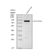 Zebrafish SLC6A4 / SLC6A4A Antibody Serotonin Transporter WB. Western blot analysis of whole zebrafish tissue lysate using Zebrafish SLC6A4 Antibody demonstrates a distinct immunoreactive band at approximately 70-80 kDa, consistent with expression of Solute Carrier Family 6 Member 4A (SLC6A4A). SLC6A4A encodes a serotonin transporter that regulates serotonergic neurotransmission through the reuptake of extracellular serotonin at neuronal synapses. The observed band migrates near the predicted molecular weight of SLC6A4A (~70 kDa) and supports detection of the endogenous protein in zebrafish tissue. Electrophoresis was performed on a 10% SDS-PAGE gel under reducing conditions followed by transfer to a nitrocellulose membrane. Signal was detected using an HRP-conjugated secondary antibody and enhanced chemiluminescent substrate. Predicted molecular weight: ~70 kDa.