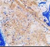 Zebrafish SLC6A4 / SLC6A4A Antibody Serotonergic Brain IHC. Immunohistochemistry staining of FFPE zebrafish brain tissue using Zebrafish SLC6A4 Antibody demonstrates widespread cytoplasmic and neurite-associated HRP-DAB brown staining throughout neural tissue compartments. Signal is observed within neuronal cell populations and surrounding neuropil-rich regions, consistent with expression of Solute Carrier Family 6 Member 4A (SLC6A4A), a serotonin transporter involved in the regulation of serotonergic neurotransmission through reuptake of extracellular serotonin. The staining pattern highlights neural structures associated with serotonin-dependent signaling pathways and neuronal communication. Heat mediated antigen retrieval was performed in EDTA buffer. Primary antibody was incubated overnight at 4Â°C followed by detection using a peroxidase-conjugated goat anti-rabbit secondary antibody and DAB chromogen.