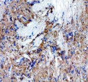 Zebrafish SLC6A4 / SLC6A4A Antibody Brain IHC. Immunohistochemistry staining of FFPE zebrafish brain tissue using Zebrafish SLC6A4 Antibody demonstrates distinct cytoplasmic HRP-DAB brown staining within scattered neuronal cell populations and neuropil-associated structures. The staining pattern is consistent with expression of Solute Carrier Family 6 Member 4A (SLC6A4A), a serotonin transporter that regulates serotonergic neurotransmission through reuptake of extracellular serotonin at neuronal synapses. Signal is observed throughout neural tissue compartments associated with neuronal communication and serotonin-dependent signaling pathways. Heat mediated antigen retrieval was performed in EDTA buffer. Primary antibody was incubated overnight at 4Â°C followed by detection using a peroxidase-conjugated goat anti-rabbit secondary antibody and DAB chromogen.