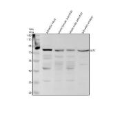 Zebrafish GCLC Antibody WB. Western blot analysis of GCLC using Zebrafish GCLC Antibody / Glutamate-Cysteine Ligase Antibody demonstrates a prominent immunoreactive band at approximately 80 kDa in zebrafish head, whole female, whole male, and embryo tissue lysates. The observed molecular weight is slightly higher than the predicted size of approximately 73 kDa, which may reflect post-translational modification or differences in electrophoretic migration. GCLC is the catalytic subunit of glutamate-cysteine ligase, the rate-limiting enzyme in glutathione biosynthesis and a central regulator of cellular antioxidant defense pathways. Consistent detection across developmental and adult tissue samples supports broad expression of GCLC and confirms recognition of the target protein. The observed immunoreactivity demonstrates the utility of this antibody for studies of glutathione metabolism, oxidative stress responses, redox regulation, detoxification pathways, developmental biology, and cellular antioxidant defense mechanisms in zebrafish models.