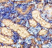 Zebrafish Cytokeratin 8 Antibody IHC. Immunohistochemistry analysis of KRT8 using anti-KRT8 antibody. KRT8 was detected in a paraffin-embedded section of zebrafish kidney tissue. Heat mediated antigen retrieval was performed in EDTA buffer. The tissue section was blocked with 10% goat serum. The tissue section was then incubated with 2 ug/ml rabbit anti-KRT8 Antibody overnight at 4oC. Peroxidase Conjugated Goat Anti-rabbit IgG was used as secondary antibody and incubated for 30 minutes at 37oC. The tissue section was developed using DAB as the chromogen.
