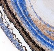 Zebrafish Cytokeratin 8 Antibody IHC. Immunohistochemistry analysis of KRT8 using anti-KRT8 antibody. KRT8 was detected in a paraffin-embedded section of zebrafish eye tissue. Heat mediated antigen retrieval was performed in EDTA buffer. The tissue section was blocked with 10% goat serum. The tissue section was then incubated with 2 ug/ml rabbit anti-KRT8 Antibody overnight at 4oC. Peroxidase Conjugated Goat Anti-rabbit IgG was used as secondary antibody and incubated for 30 minutes at 37oC. The tissue section was developed using DAB as the chromogen.