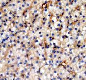 Zebrafish Cytokeratin 8 Antibody IHC. Immunohistochemistry analysis of KRT8 using anti-KRT8 antibody. KRT8 was detected in a paraffin-embedded section of zebrafish eye tissue. Heat mediated antigen retrieval was performed in EDTA buffer. The tissue section was blocked with 10% goat serum. The tissue section was then incubated with 2 ug/ml rabbit anti-KRT8 Antibody overnight at 4oC. Peroxidase Conjugated Goat Anti-rabbit IgG was used as secondary antibody and incubated for 30 minutes at 37oC. The tissue section was developed using DAB as the chromogen.