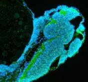 Zebrafish TUBA1A Antibody Embryo IF. Immunofluorescent staining of paraffin-embedded zebrafish embryo tissue using Zebrafish TUBA1A Antibody / Alpha Tubulin Antibody demonstrates strong green fluorescence throughout developing neural and embryonic tissue structures, consistent with the widespread distribution of alpha tubulin-containing microtubule networks during embryogenesis. TUBA1A is a highly conserved cytoskeletal protein required for microtubule assembly, neuronal differentiation, intracellular transport, and tissue morphogenesis. The staining pattern highlights regions of active cellular organization and developmental growth, while DAPI (blue) counterstains cell nuclei. Heat-mediated antigen retrieval was performed in EDTA buffer. Sections were blocked with 10% goat serum and incubated overnight at 4Â°C with 5 Âµg/ml primary antibody, followed by DyLight 488-conjugated goat anti-rabbit IgG secondary antibody at 1:500 dilution for 30 minutes at 37Â°C.
