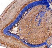 Zebrafish PTF1A Antibody Brain IHC. Immunohistochemical staining of paraffin-embedded zebrafish brain tissue using Zebrafish PTF1A Antibody / Pancreas Transcription Factor 1A Antibody demonstrates widespread cytoplasmic and nuclear HRP-DAB brown staining throughout neural tissue structures. The staining pattern is consistent with expression of PTF1A, a basic helix-loop-helix transcription factor that plays essential roles in cellular differentiation and developmental patterning. Although best known for its function in pancreatic development, PTF1A also contributes to the specification and maturation of distinct neuronal populations during vertebrate embryogenesis. The observed expression within zebrafish brain tissue is consistent with the established involvement of PTF1A in nervous system development and neural lineage determination. Heat-mediated antigen retrieval was performed in EDTA buffer, followed by overnight incubation with 2 Âµg/ml primary antibody and HRP-DAB visualization.