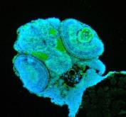 Zebrafish JAG1 Antibody IF. Immunofluorescent staining of paraffin-embedded zebrafish embryo tissue using Zebrafish JAG1 Antibody / Jagged 1b Antibody demonstrates green fluorescence within developing embryonic structures, including regions associated with organogenesis and tissue patterning. The staining pattern is consistent with expression of JAG1B, a transmembrane Notch ligand that mediates cell-cell communication during vertebrate development. JAG1B plays important roles in cell fate determination, differentiation, tissue morphogenesis, and regulation of Notch signaling pathways. HIER was performed using EDTA buffer prior to staining. Tissue sections were blocked with 10% goat serum and incubated with primary antibody at 5 ug/ml overnight at 4C. DyLight-488-conjugated goat anti-rabbit IgG was used as the secondary antibody (green), and nuclei were counterstained with DAPI (blue). The image supports detection of JAG1B expression in developing zebrafish embryonic tissues by immunofluorescence.