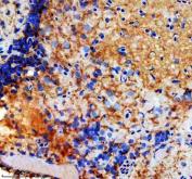 Zebrafish GNRHR4 Antibody Brain IHC. Immunohistochemistry staining of paraffin-embedded zebrafish brain tissue using GNRHR4 antibody demonstrates widespread cytoplasmic and membranous staining within neural cell populations, consistent with expression of Gonadotropin-Releasing Hormone Receptor 4 (GNRHR4). GNRHR4 is a G protein-coupled receptor that mediates neuroendocrine signaling pathways involved in hormonal communication, reproductive regulation, and endocrine system function. The observed staining pattern within brain tissue is consistent with the established role of GnRH receptor family members in coordinating neuronal and endocrine signaling networks that regulate physiologic homeostasis and vertebrate development. Heat-mediated antigen retrieval was performed in EDTA buffer. Tissue sections were stained with 2 ug/ml primary antibody and visualized using DAB chromogen.