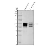 Zebrafish Desmin Antibody WB. Western blot analysis of DESMA using anti-Desmin antibody demonstrates prominent immunoreactive bands at approximately 50 kDa in zebrafish head and embryo tissue lysates, consistent with the expected molecular weight of Desmin, the zebrafish ortholog of human DES. Desmin is a type III intermediate filament protein that forms an essential component of the muscle cytoskeleton, providing structural support and mechanical integrity within skeletal, cardiac, and smooth muscle cells. The observed expression in both developmental and adult-associated tissues is consistent with the established role of Desmin in muscle formation, cytoskeletal organization, and maintenance of tissue architecture. Western blot was performed using 0.5 ug/ml primary antibody. Predicted molecular weight: ~54 kDa.