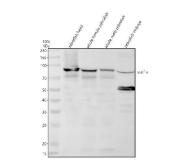 Zebrafish STAT1 Antibody WB. Western blot analysis of STAT1A using anti-STAT1A antibody demonstrates a prominent immunoreactive band at approximately 86 kDa in zebrafish head, whole female, whole male, and embryo tissue lysates, consistent with the expected molecular weight of STAT1, the zebrafish ortholog of human Signal Transducer and Activator of Transcription 1. STAT1 is a key transcription factor within the JAK-STAT signaling pathway that mediates interferon responses, cytokine signaling, and immune regulatory processes. The observed expression across developmental and adult tissue samples is consistent with the broad biologic role of STAT1 in host defense, transcriptional regulation, and cellular signaling. Western blot was performed using 0.5 ug/ml primary antibody. Predicted molecular weight: ~86 kDa.
