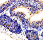 Zebrafish CD36 Antibody IHC. Immunohistochemistry analysis of CD36 using anti-CD36 antibody. CD36 was detected in a paraffin-embedded section of zebrafish small intestine tissue. Heat mediated antigen retrieval was performed in EDTA buffer. The tissue section was blocked with 10% goat serum. The tissue section was then incubated with 2 ug/ml rabbit anti-CD36 Antibody overnight at 4oC. Peroxidase Conjugated Goat Anti-rabbit IgG was used as secondary antibody and incubated for 30 minutes at 37oC. The tissue section was developed using DAB as the chromogen.