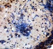 Zebrafish FABP6 Antibody Brain IHC. Immunohistochemical analysis of FABP6 expression using anti-FABP6 antibody in paraffin embedded zebrafish brain tissue. FABP6, also known as Ileal Lipid Binding Protein and Gastrotropin, is a member of the fatty acid binding protein family that mediates intracellular transport of bile acids and other hydrophobic molecules involved in lipid metabolism. Distinct cytoplasmic staining is observed in neuronal and surrounding cells, suggesting expression of FABP6 in the zebrafish nervous system and supporting emerging roles for bile acid signaling in neural physiology. Heat mediated antigen retrieval was performed in EDTA buffer prior to staining. Sections were blocked with 10 percent goat serum and incubated with FABP6 antibody at 2 ug/ml overnight at 4 degrees Celsius. Detection was achieved using a peroxidase conjugated goat anti rabbit IgG secondary antibody and DAB chromogen. These results support the utility of Zebrafish FABP6 Antibody for studies of lipid metabolism, bile acid signaling, and developmental biology.