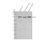 Zebrafish EPHA2 Antibody WB. Western blot analysis of EPHA2A expression was performed using anti-EPHA2 antibody. Electrophoresis was carried out on a 10% SDS-PAGE gel under reducing conditions. Lane 1: zebrafish head tissue lysate. Lane 2: whole female zebrafish tissue lysate. Lane 3: whole male zebrafish tissue lysate. EPHA2A, also known as Eph Receptor A2a, is a receptor tyrosine kinase involved in cell-cell communication, tissue patterning, and developmental signaling. A specific immunoreactive band is detected at approximately 109 kDa in all three samples, corresponding to the expected molecular weight of EPHA2A. Similar expression in head and whole-body lysates is consistent with the broad distribution of Eph receptor signaling pathways in neural and peripheral tissues. These results support the utility of Zebrafish EPHA2 Antibody for studies of receptor tyrosine kinase signaling, cell migration, and vertebrate development.