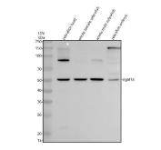 Zebrafish DGAT1 Antibody WB. Western blot analysis of DGAT1A expression was performed using anti-DGAT1A antibody. Electrophoresis was carried out on a 10% SDS-PAGE gel under reducing conditions. Lane 1: zebrafish head tissue lysate. Lane 2: whole female zebrafish tissue lysate. Lane 3: whole male zebrafish tissue lysate. Lane 4: zebrafish embryo tissue lysate. DGAT1A, also known as Diacylglycerol O-Acyltransferase 1A, catalyzes the final and committed step of triglyceride synthesis and plays an essential role in lipid storage and energy metabolism. A specific immunoreactive band is detected at approximately 50 kDa in all four samples, corresponding closely to the expected molecular weight of DGAT1A (~57 kDa). Similar expression in head, whole-body, and embryo lysates is consistent with the widespread requirement for triglyceride synthesis during growth and development. These results support the utility of Zebrafish DGAT1 Antibody for studies of lipid metabolism, energy homeostasis, and vertebrate development.