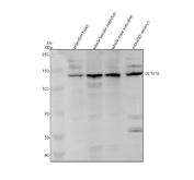 Zebrafish Collagen I Antibody WB. Western blot analysis of COL1A1A using anti-COL1A1A antibody. Electrophoresis was performed on a 8% SDS-PAGE gel for 2 hours. The sample well of each lane was loaded with 30 ug of sample under reducing conditions. Lane 1: zebrafish head tissue lysates, Lane 2: whole female zebrafish tissue lysates, Lane 3: whole male zebrafish tissue lysates, Lane 4: zebrafish embryo tissue lysates. After electrophoresis, proteins were transferred to a nitrocellulose membrane at 150 mA for 50-90 minutes. Blocked the membrane with 5% non-fat milk/TBS for 1.5 hour at RT. The membrane was incubated with rabbit anti-COL1A1A antigen antibody at 0.5 ug/ml overnight at 4oC, then washed with TBS-0.1%Tween 3 times with 5 minutes each and probed with a goat anti-rabbit IgG-HRP secondary antibody at a dilution of 1:5000 for 1.5 hour at RT. The signal is developed using an ECL Plus WB. Western blotting Substrate with Tanon 5200 system. A specific band was detected for COL1A1A at approximately 137 kDa. The expected band size for COL1A1A is at 137 kDa.