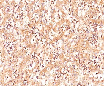 IHC testing of human fetal liver stained with AFP antibody (C3).~