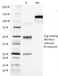 SDS-PAGE Analysis of Purified, BSA-Free AFP Antibody (clone C3). Confirmation of Integrity and Purity of the Antibody.