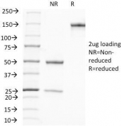 SDS-PAGE Analysis of Purified, BSA-Free PSA Antibody (A67-B/E3). Confirmation of Integrity and Purity of the Antibody.