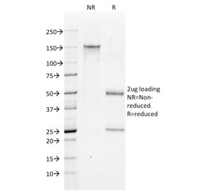 SDS-PAGE analysis of purified, BSA-free Bax antibody (clone 2D2) as confirmation of integrity and purity.